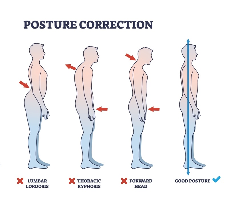 Postural analysis calibrated grid system at Physio Aalaya